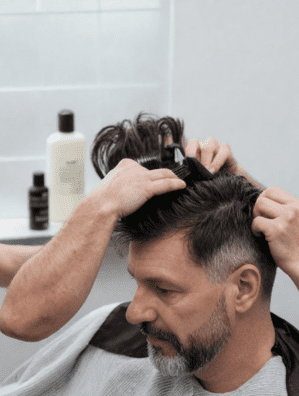 Non-Surgical Hair Replacement