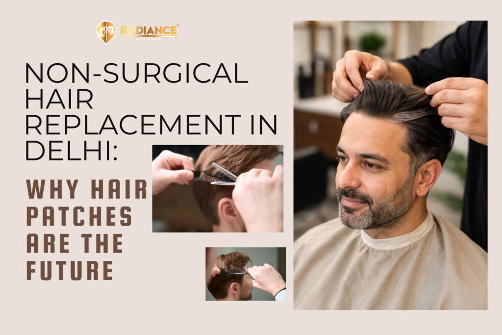 Non-Surgical Hair Replacement in Delhi