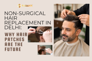 Non-Surgical Hair Replacement in Delhi