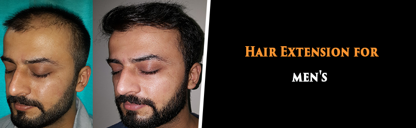 Mens Hair Extensions at Rs 4500pieces  Malleshwaram  Bengaluru  ID  6443878430